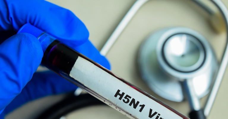 The United States reports its first death from bird flu. What to Know about It